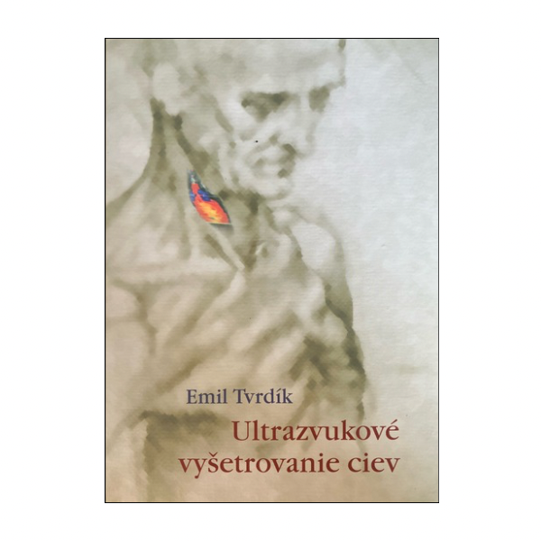 Ultrazvukové vyšetrovanie ciev