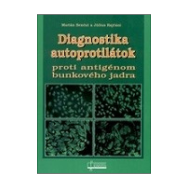 Diagnostika autoprotilátok proti antigénom bunkového jadra