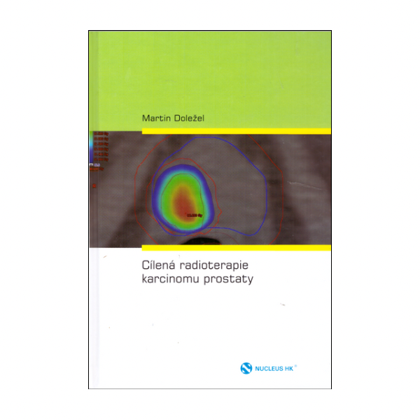 Cílená radioterapie karcinomu prostaty