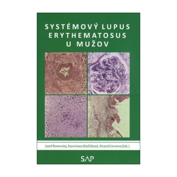 Systémový lupus erythematosus u mužov