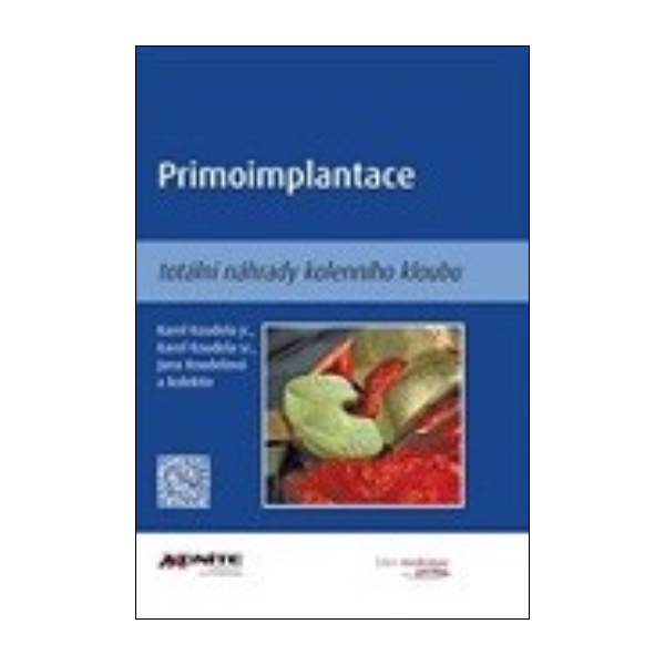 Primoimplantace totální náhrady kolenního kloubu