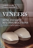 Veneers - Mini-invasive Reconstructions