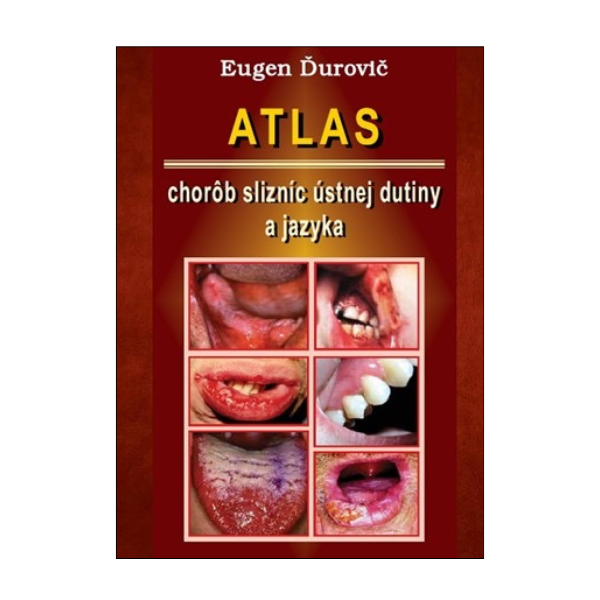Atlas chorôb slizníc ústnej dutiny a jazyka