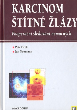 Karcinom štítné žlázy