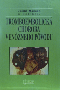 Tromboembolická choroba venózneho pôvodu