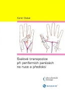 Svalové transpozice při periferních parézách na ruce a předloktí