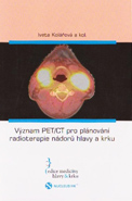 Význam PET/CT pro plánování radioterapie nádorů hlavy a krku