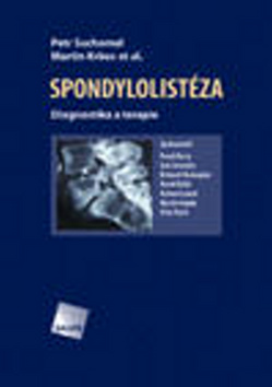 Spondylolistéza