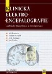Klinická elektroencefalografie