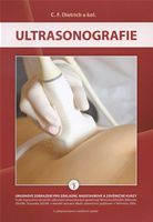 Ultrasonografie