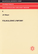 Folikulární lymfomy