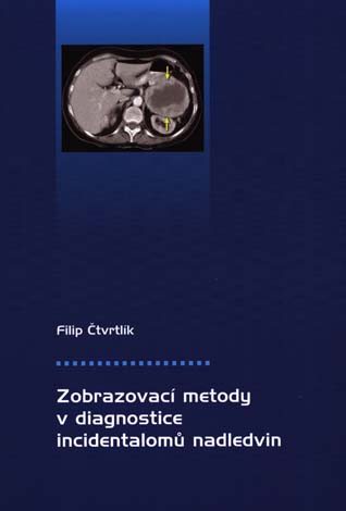 Zobrazovací metody v diagnostice incidentalomů nadledvin