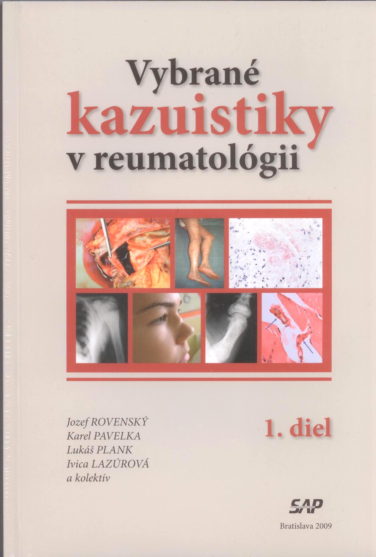 Vybrané kazuistiky v reumatológii 1+2