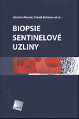 Biopsie sentinelové uzliny