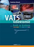 VATS lobektomie 