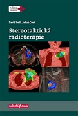 Stereotaktická radioterapie