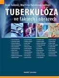 Tuberkulóza ve faktech i obrazech