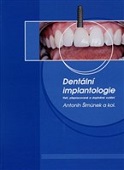 Dentální implantologie