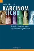 Karcinom jícnu