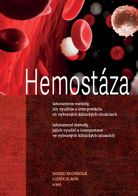 Hemostáza, laboratorní metody, jejich využití a interpretace ve vybraných 