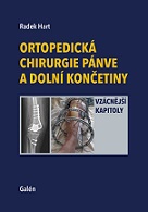 Ortopedická chirurgie pánve a dolní končetiny - Vzácnější kapitoly