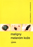 Malígny melanóm kože