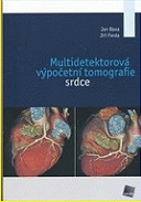 Multidetektorová výpočetní tomografie srdce