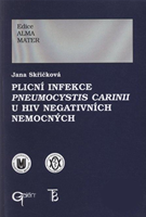 Plicní infekce Pneumocystis carinii u HIV negativních nemocných