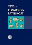 Zlomeniny patní kosti