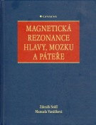 Magnetická rezonance hlavy, mozku a páteře