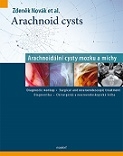 Arachnoid cysts. Arachnoidální cysty mozku a míchy