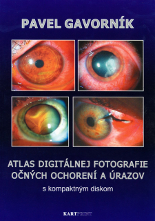 Atlas digitálnej fotografie očných ochorení a úrazov s kompaktným diskom