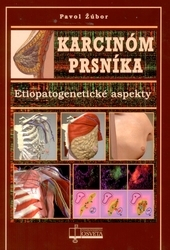 Karcinóm prsníka 