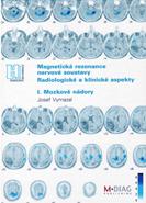 Magnetická rezonance nervové soustavy. Radiologické a klinické aspekty - I.