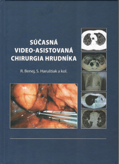 Súčasná video-asistovaná chirurgia hrudníka