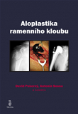 Aloplastika ramenního kloubu