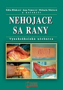 Nehojace sa rany