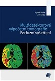 Multidetektorová výpočetní tomografie. Perfuzní vyšetření