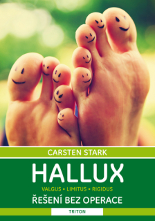 Hallux: řešení bez operace 