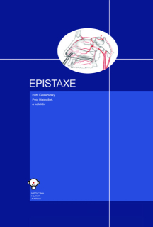 Epistaxe