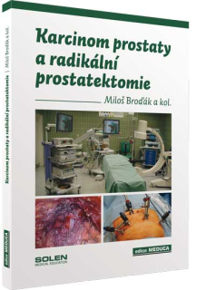 Karcinom prostaty a radikální prostatektomie