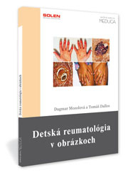Detská reumatológia v obrázkoch