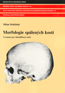 Morfologie spálených kostí - Význam pro identifikace osob