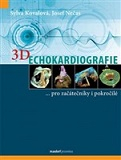 3D Echokardiografie
