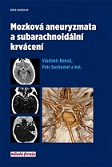 Mozková aneuryzmata a subarachnoidální krvácení