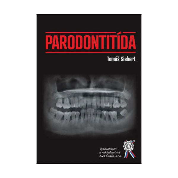 Parodontitída